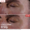 ERBORIAN Skin Therapy Eye 12